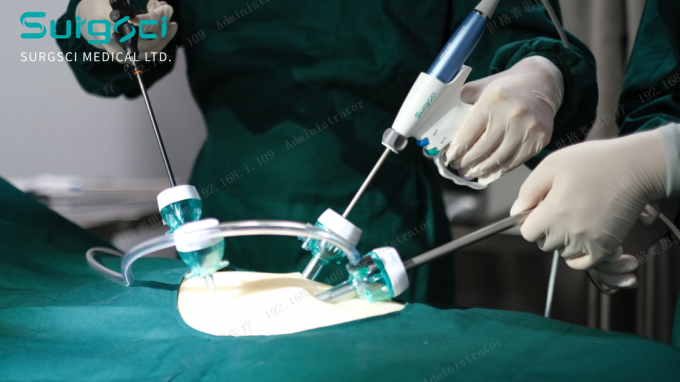 hakkında en son şirket haberleri Trokar Kesi Yerleri | SurgSci 0