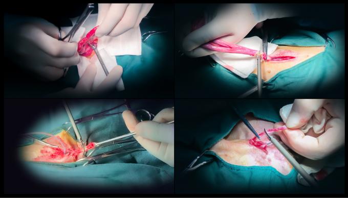 Veteriner Kullanımı İçin Laparoskop Cerrahisi Ultrasonik Neşter Sistemi Hemostaz 6