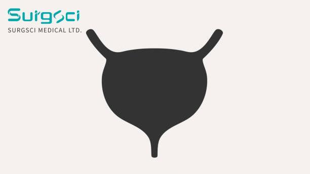 hakkında en son şirket haberleri Mesane tüberkülozunun klinik sınıflandırılması.  0